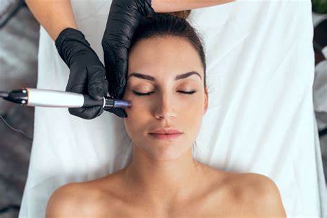 Learn the most up to date skin needling skills
